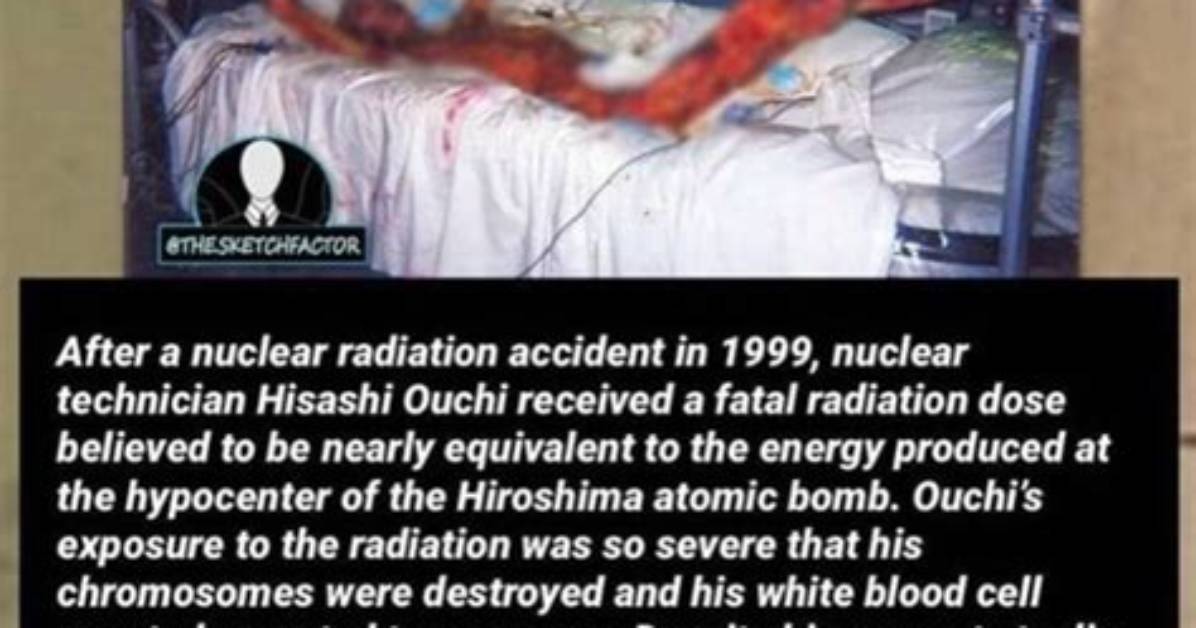 Unraveling the Ouchi Nuclear Accident: a Tragic Chapter in Japan's History