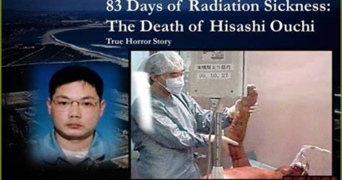 Unraveling the Tragic Tale of Hisashi Ouchi's Death