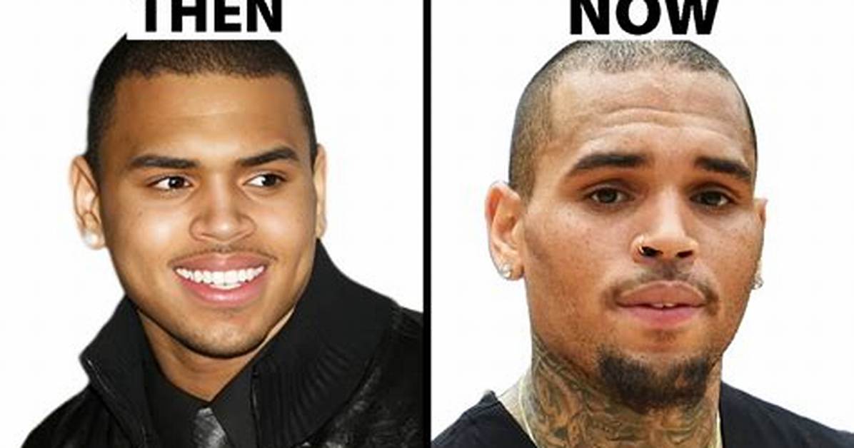 Unraveling the Truth: Does Chris Brown Have Herpes?
