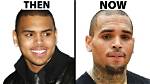 Unraveling the Truth: Does Chris Brown Have Herpes?
