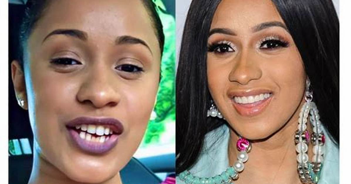 Unveiling Cardi B's Teeth Transformation: a Journey of Discovery