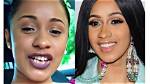 Unveiling Cardi B's Teeth Transformation: a Journey of Discovery