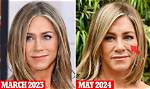 Unveiling Jennifer Aniston's Timeless Beauty: Plastic Surgery Truths Revealed