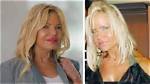 Unveiling Lisa Helou's Transformation: Pre-Plastic Surgery Insights