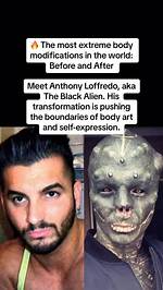 Unveiling the Extraordinary Journey of Anthony Loffredo