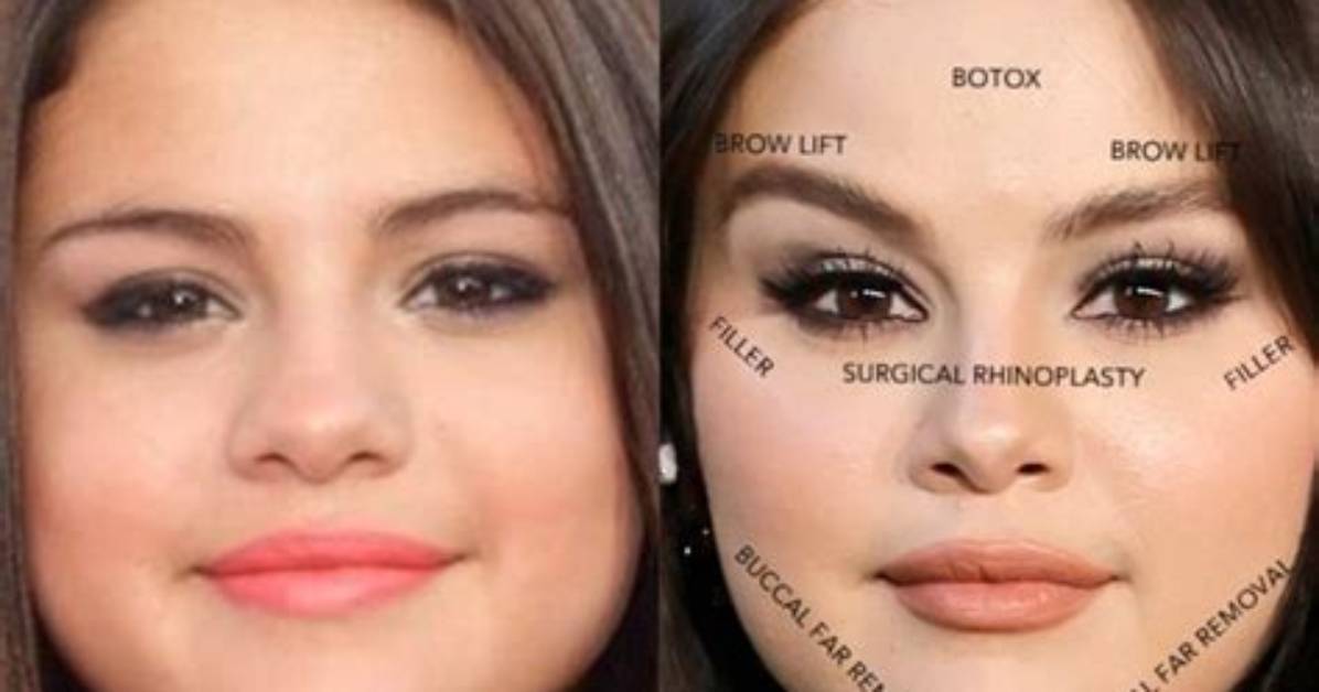 Unveiling the Life of Selena Gomez's Mother: a Look at Her Age and More