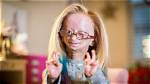 Unveiling the Story: What Did Adalia Rose Have?