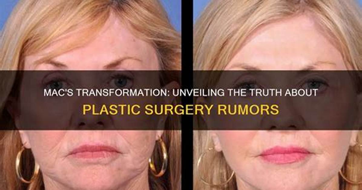 Unveiling the Transformation: Ahna Mac Face Surgery