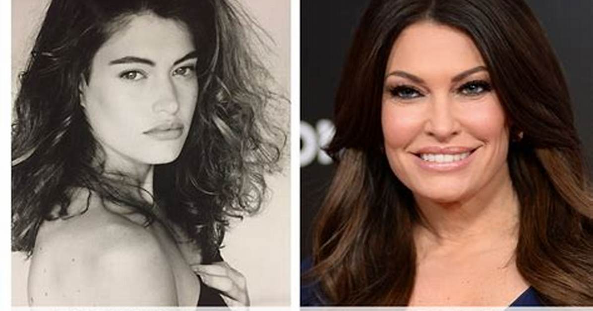 Unveiling the Transformation: Kimberly Guilfoyle Before Cosmetic Surgery
