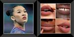 Unveiling the Truth Behind Suni Lee Lip Fillers