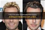 Unveiling the Truth: Chad Kroeger's Plastic Surgery Journey