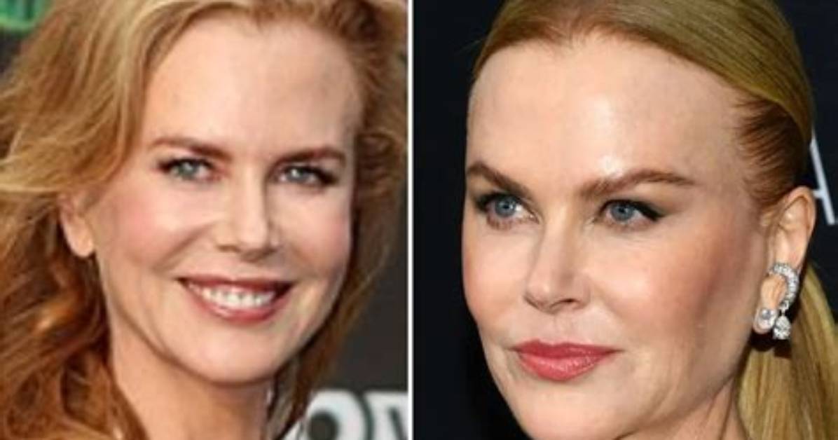 Unveiling the Truth: Did Nicole Kidman Have a Boob Job?