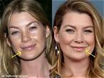 Unveiling the Truth: Ellen Pompeo Lips