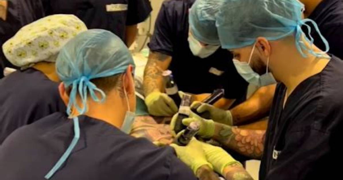 Unveiling the Wonders of Tattooing Under Anesthesia: a Transformative Journey