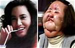 What Became of Hang Mioku After He Underwent Endless Plastic Surgery? Know What She Is Doing Right Now