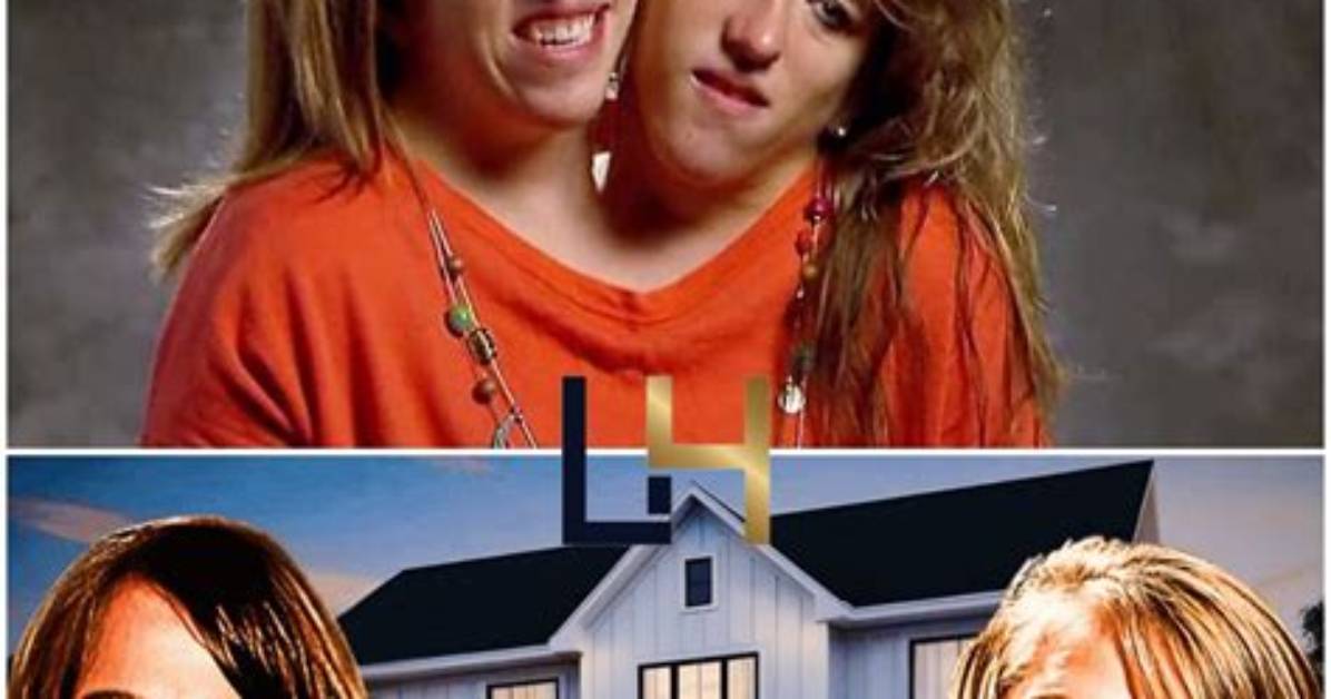 What Really Happened to Abby and Brittany Hensel? Did They Pass Away?