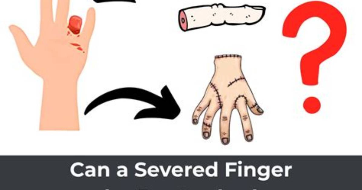 What to Do with the Severed Hand in Remnant 2