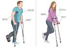 Where Do I Put My Crutches on a Plane? |