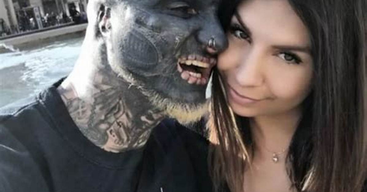 Who Is Anthony Loffredo Wife? Before and After Photos of the Most Modified Man Who Chopped off Two F
