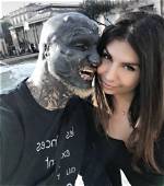 Who Is Anthony Loffredo Wife? Before and After Photos of the Most Modified Man Who Chopped off Two F