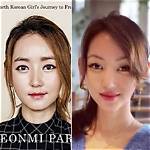 Yeonmi Park's Plastic Surgery Journey and the Transformative Power of Transformation
