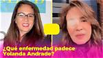 Yolanda Andrade: a Journey Through Fame and Controversy