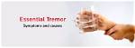 Your Ultimate Guide to Understanding Essential Tremors