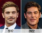 Zac Efron 2023 Vs. 2024: a Transformation Worth Exploring